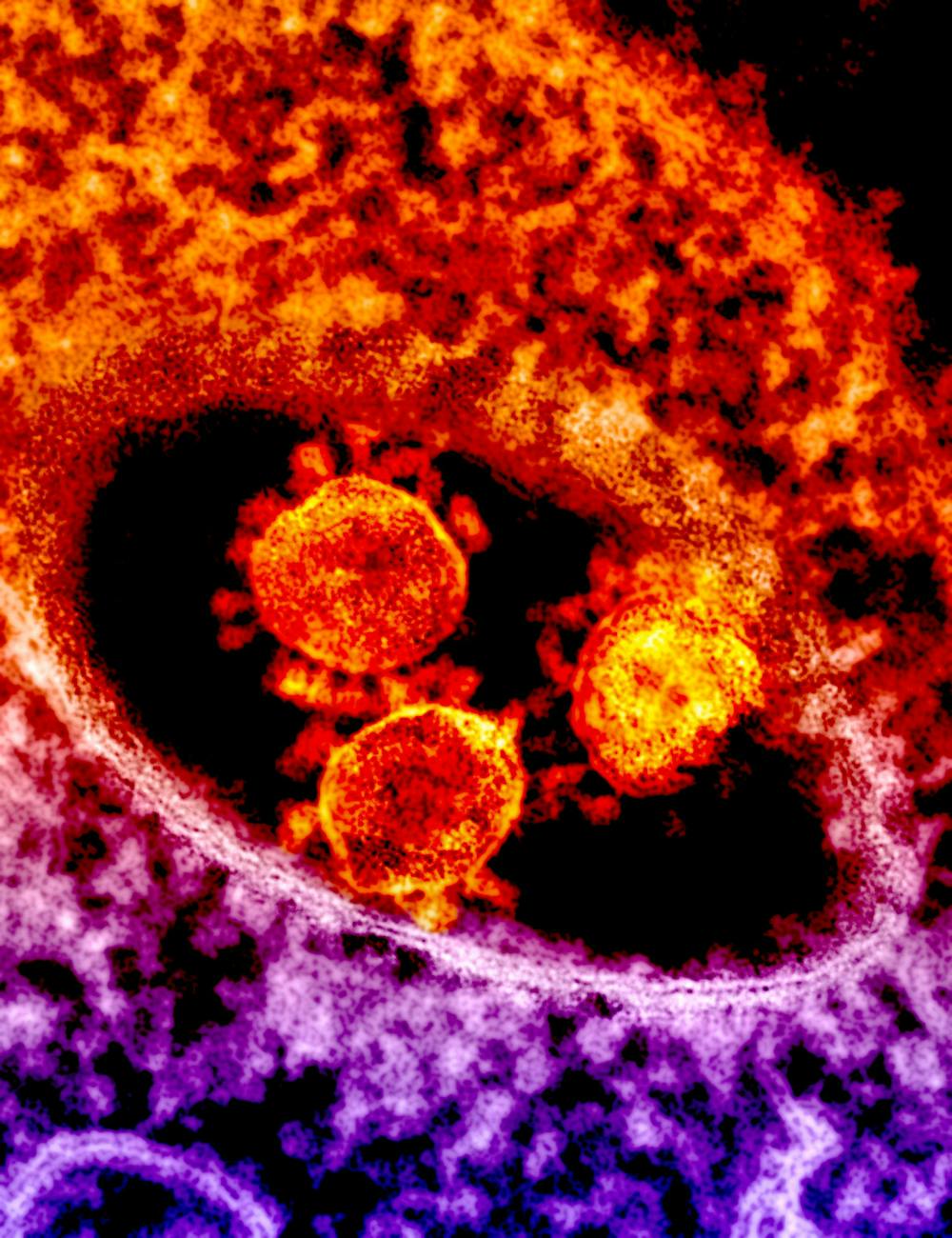 microscopic image of a virus